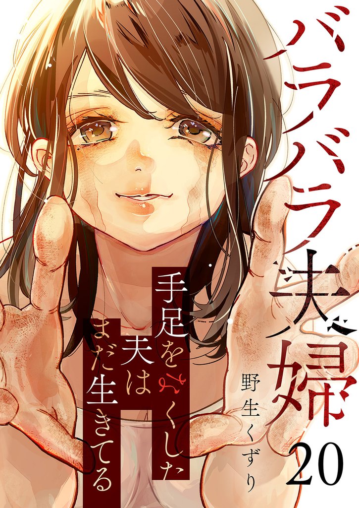 バラバラ夫婦～手足をなくした夫はまだ生きてる２０